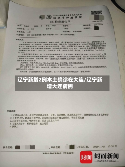辽宁新增2例本土确诊在大连/辽宁新增大连病例-第2张图片